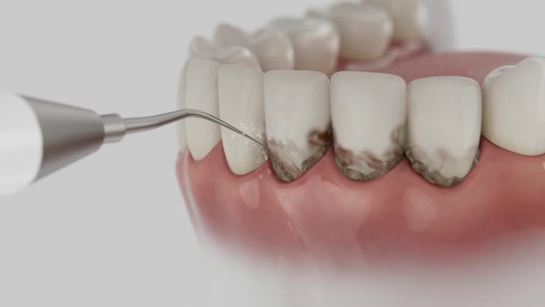 Trusted Teeth Cleaning And Checkup service in North Redington Beach, FL - Dentist Open Now